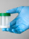 pojemnik zawierający próbke spermy trzymany w ręce w niebieskiej jednorazowej rekawiczce diagnostycznej